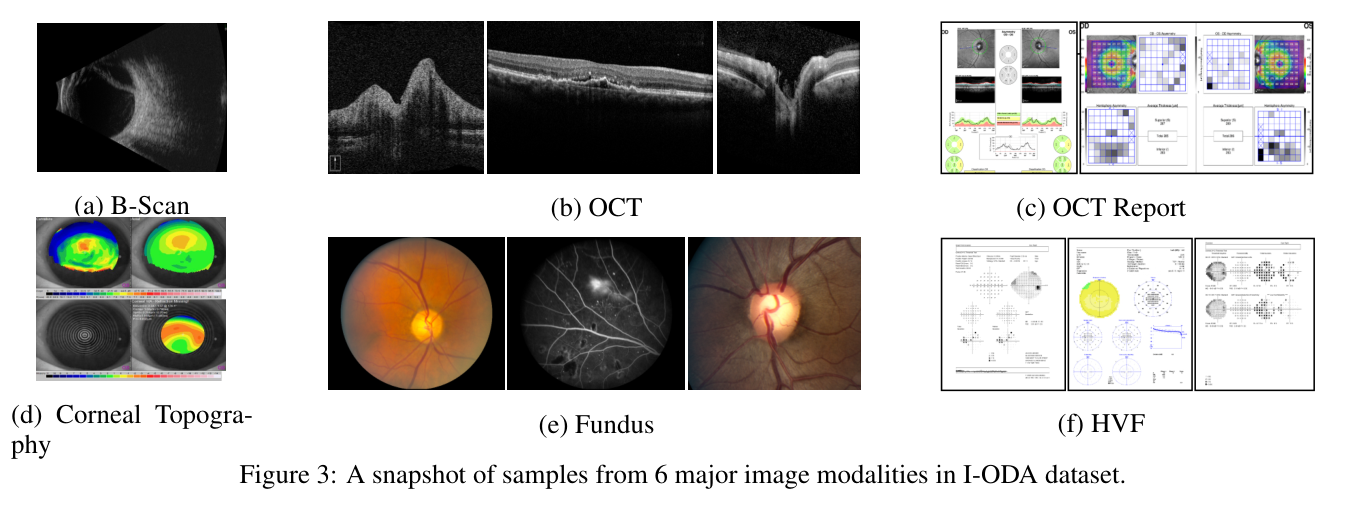 Sample images from six major imaging modalities in the I-ODA dataset: B-scan, OCT, OCT report, corneal topography, fundus photography, and Humphrey visual field