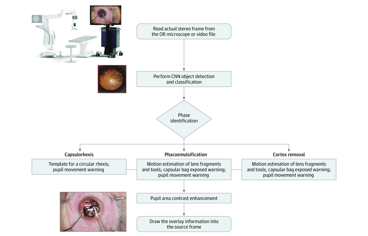 AI intraoperative-guidance workflow for phacoemulsification cataract surgery: read a stereo frame from the OR microscope, run CNN detection, identify the surgical phase, and render phase-specific guidance overlays