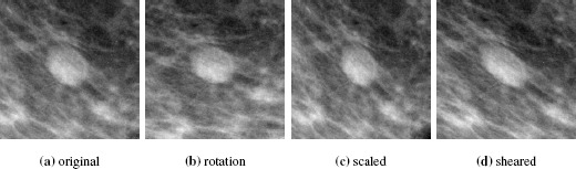 Example training data and augmentation strategies (original, rotation, scaling, shearing) used in distributed multi-institutional deep learning