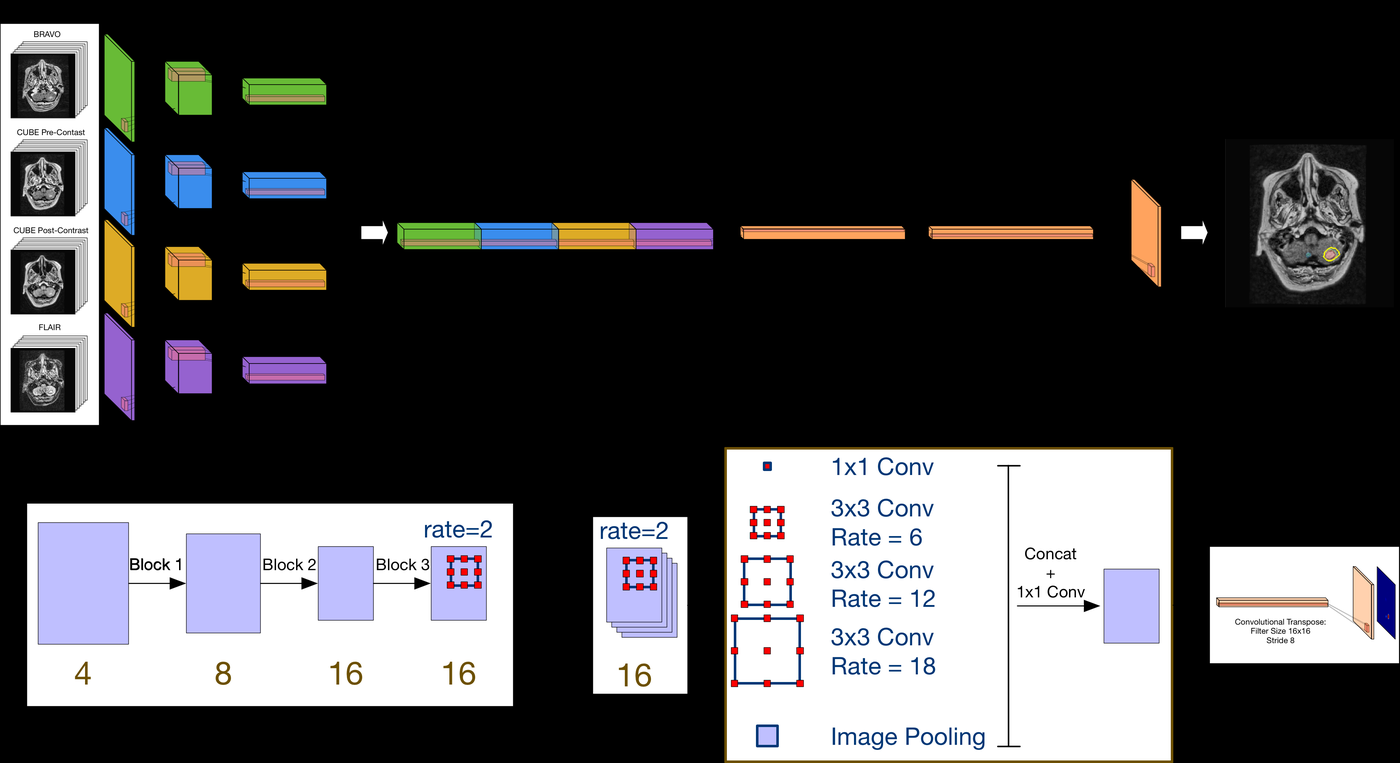 Multi-sequence fusion architecture: four input MRI pulse sequences (BRAVO, CUBE pre-contrast, CUBE post-contrast, FLAIR) feed parallel weight-shared branches into an ASPP-style decoder producing a brain-metastasis probability map