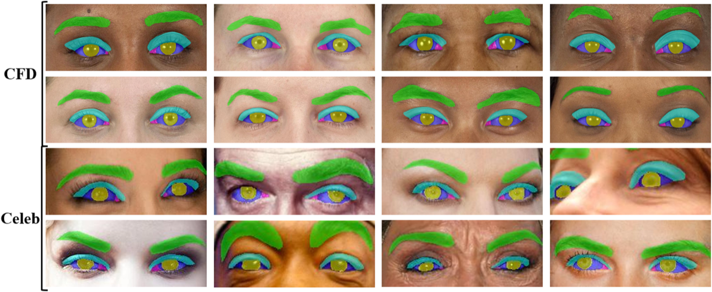 Grid of periorbital photographs from the CFD and Celeb source datasets with multi-class color-coded segmentation overlays: eyebrows, upper eyelid, sclera, iris, and caruncle